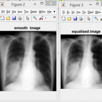 تشخیص ناحیه ریه در تصاویر xray در متلب