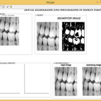 تشخیص هویت انسان از روی دندان با کمک پردازش تصویر