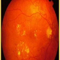 استخراج خطوط مرکزی رگ‌های شبکیه چشم در متلب