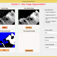 تشخیص و جداسازی دندان در تصاویر xray  در متلب با کمک روش FCM