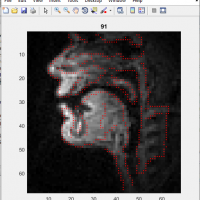 پیشرفته ترین روش پردازش تصویر برای تشخیص پوسیدگی دندان