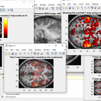 تشخیص و دسته بندی داده های تومور های مغزی با روش fmri  در متلب :پروژه متلب