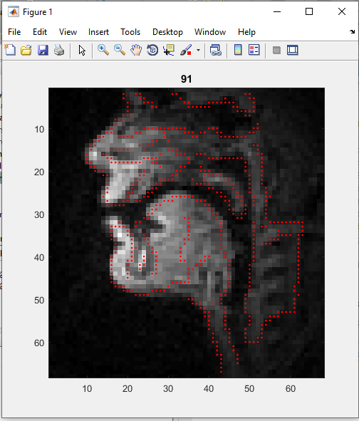 پیشرفته ترین روش پردازش تصویر برای تشخیص پوسیدگی دندان