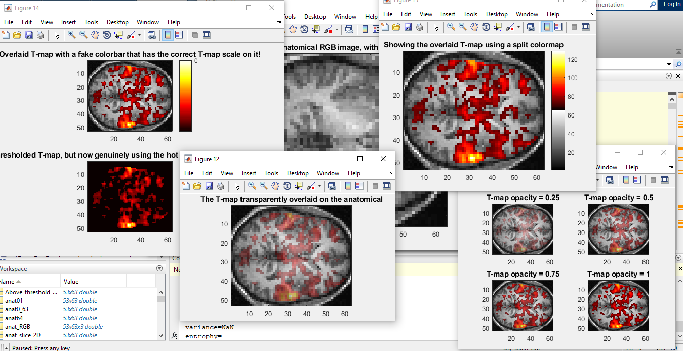 تشخیص و دسته بندی داده های تومور های مغزی با روش fmri  در متلب :پروژه متلب